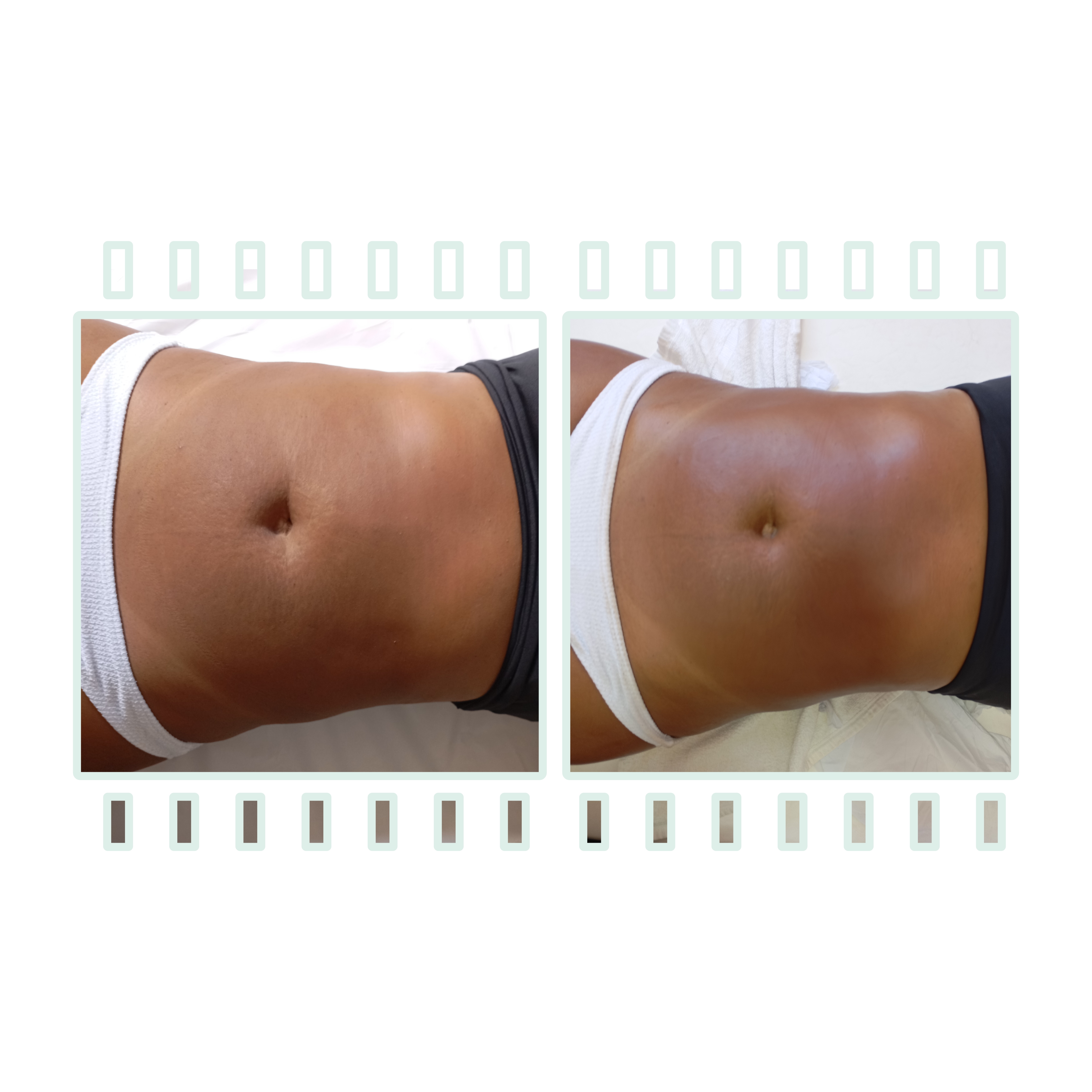 Studio Eliene (Massagem modeladora + eletroterapia localizada) — foto 7