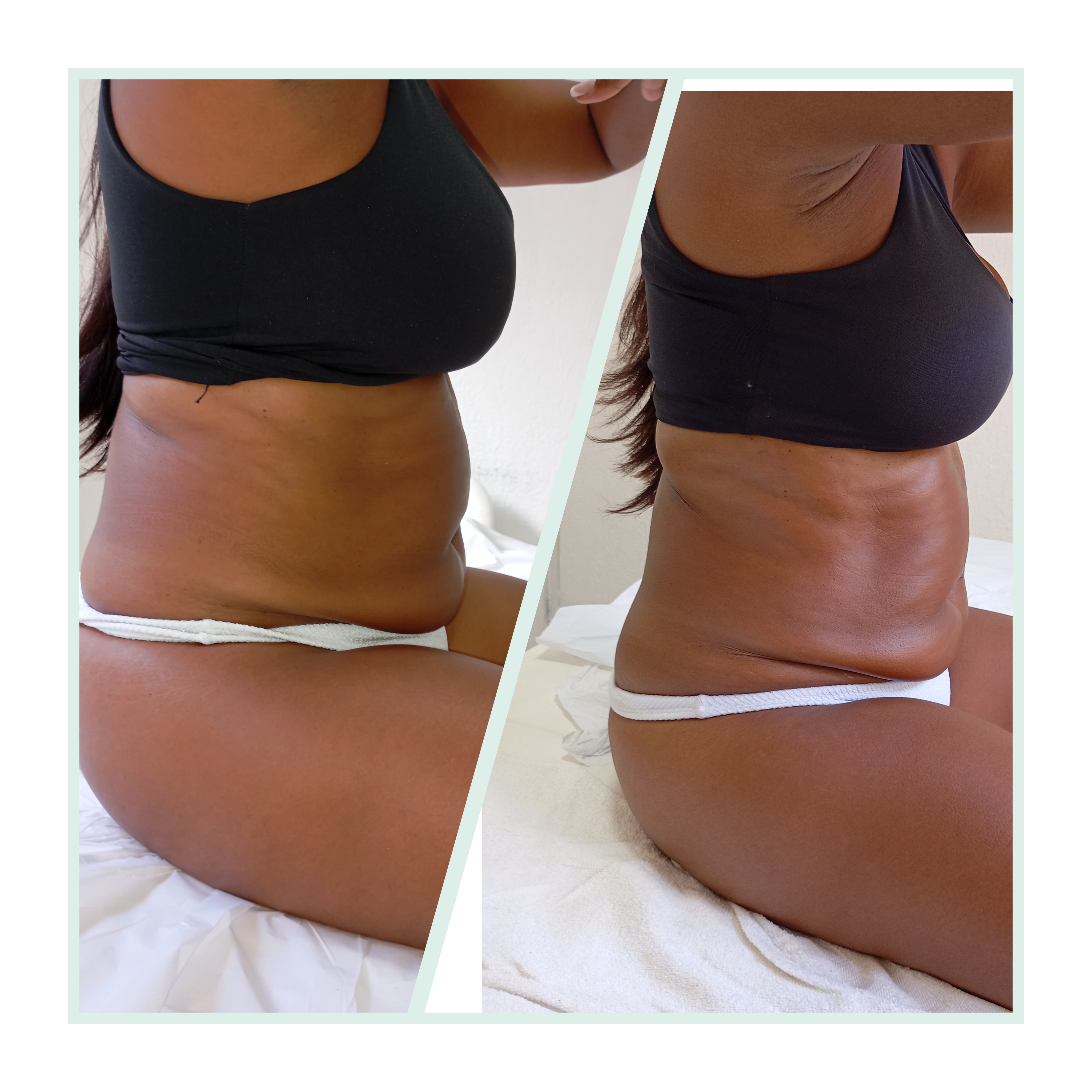 Studio Eliene (Massagem modeladora + eletroterapia localizada) — foto 5